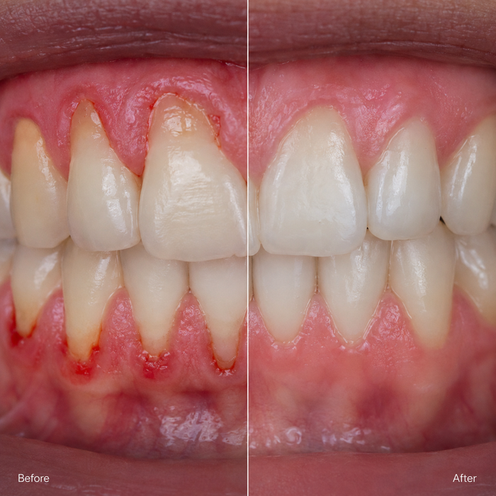 wk 0 / wk 4