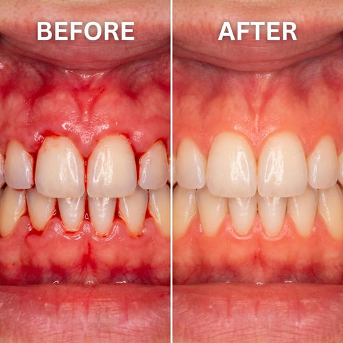 Gum Repair Gel